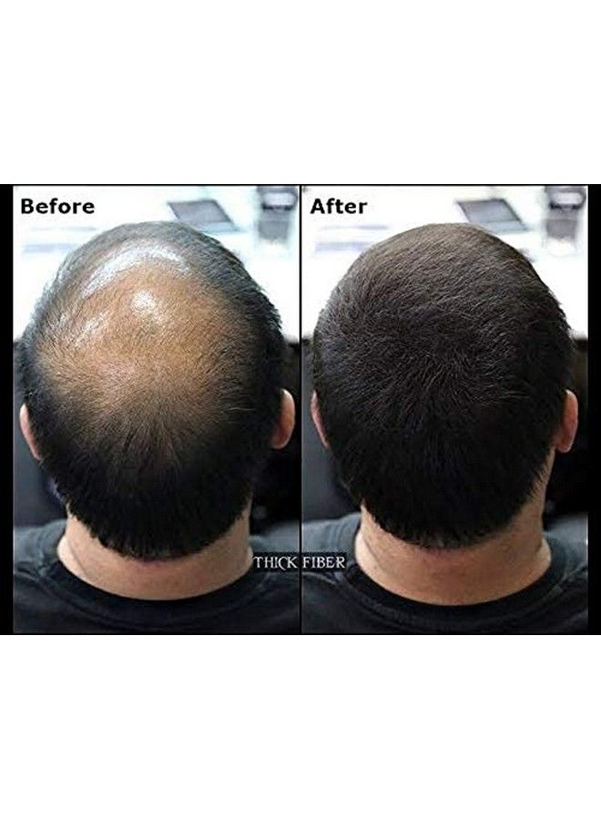 Thick Fiber ألياف بناء الشعر للجنسين للشعر الخفيف (زجاجة سوداء 25 جرام) - Image 5