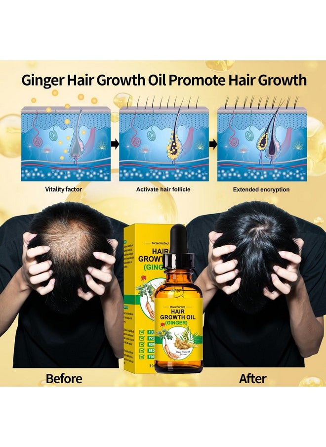 Clothes of skin Batana Oil for Hair Growth,Organic Raw Batana Oil Hair Mask & Ginger Hair Growth Oil,Hair Oil Hair Treatment for Frizzy Damaged Hair,For Thicker-Strong Hair,Nourishes Scalp,Repair Dry Damaged Hair  - Image 3