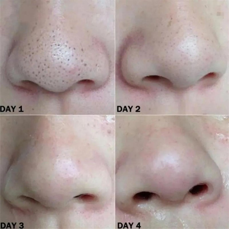 BAMBOO CHARCOAL PORE CLEANSING NOSE STRIPS 10PCS - Image 5