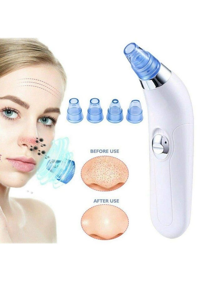 JRT 4 in 1 Multi-function Skin Care Expert Acne Pore Cleaner Vacuum Blackhead Remover Kit Skin Cleaner, Pimple Removal Tool, Acne Removal Tool, Blackhead Remover Tool (White) - Image 3