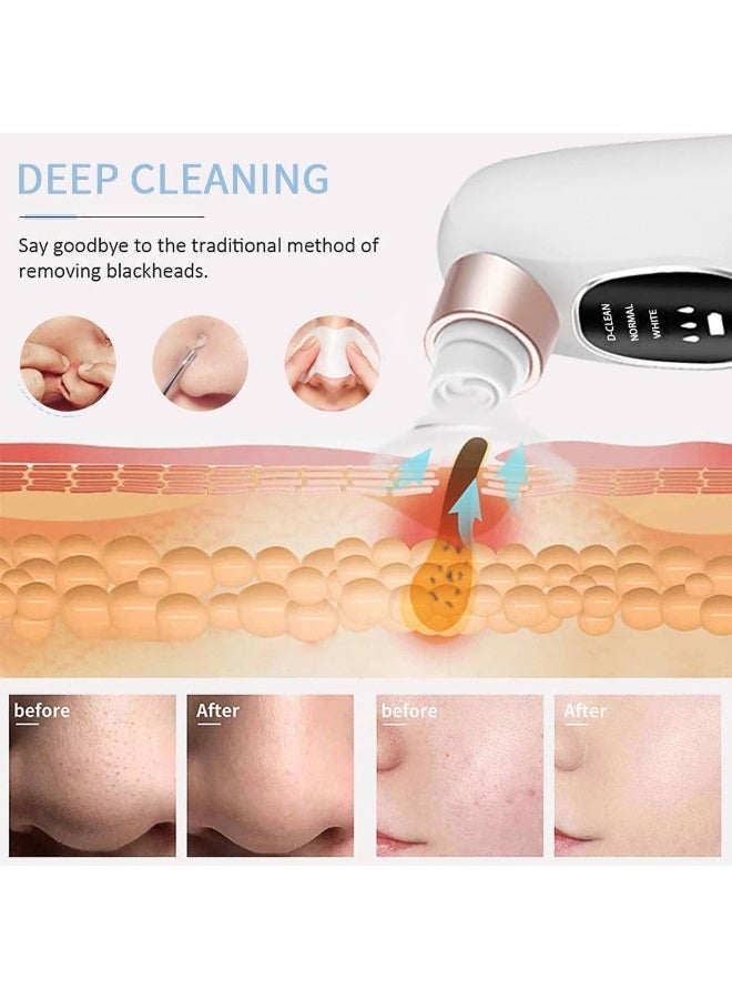 Blackhead Remover Vacuum Cleaner with Water Cycle System – Electric Facial Pore Cleaner for Acne, Pimples & Deep Blackhead Removal - Image 4