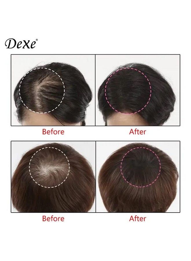 eAmaze Dexe Root Cover Up 6Gm (Black) Instantly Cover Greys + Touch Up Highlights Create Thickerlooking Hairlines Waterresistant Sweatresistant Root Concealer (Black) - Image 4