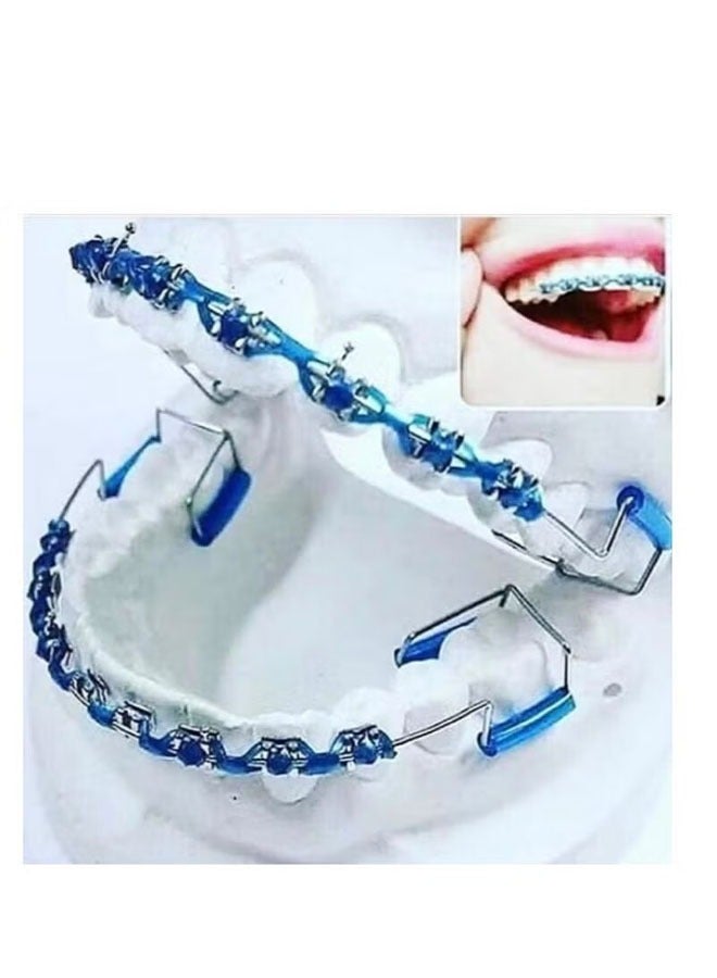 Orthodontics Without Glue, Blue Color orthodontic brackets metal brackets - Image 1