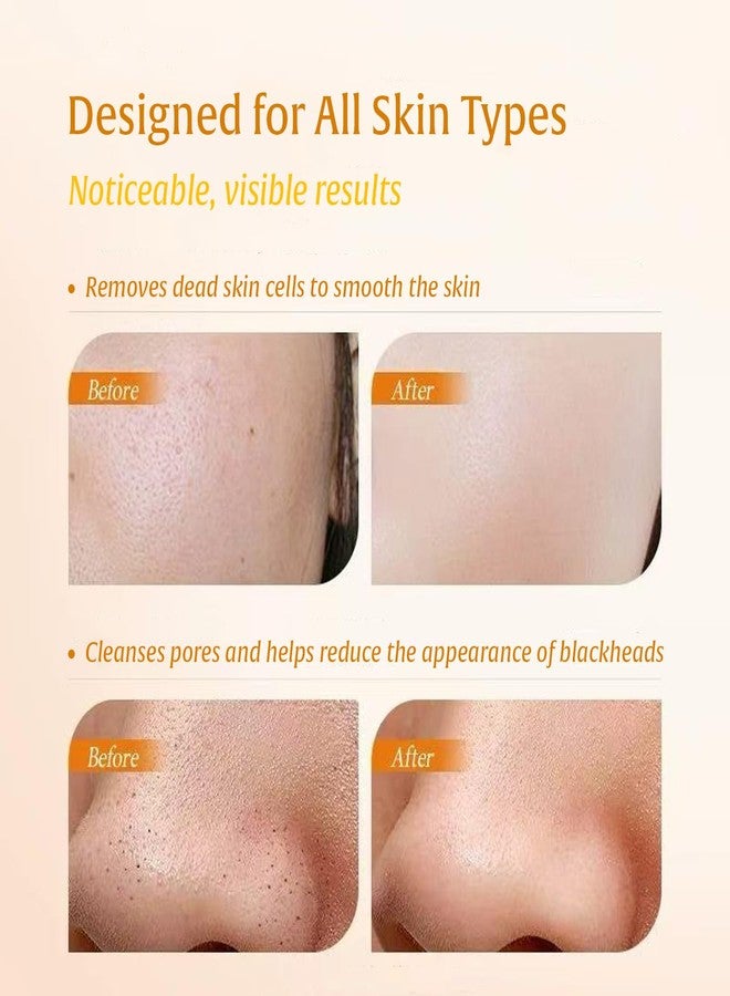 Dermendure Turmeric Kojic Acid Exfoliating Gel – Brightening Peeling Gel, Deep Pore Cleanser Minimizer Exfoliator, Face Scrub Dead Skin Cells Remover, Blackhead Remover, Korean Skin Care, 142g/5oz - Image 3