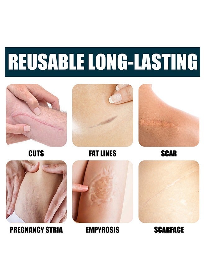 Jaysuing Advanced Scar Gel, Fade Scar Cream Gel，Acne Scar Treatment，Deep Scar Removal，Burns Keloids Hypertrophic, Scar Repair Cream，Suitable for Burn Scar Stretch Marks and Postoperative Repair Treatment - Image 3