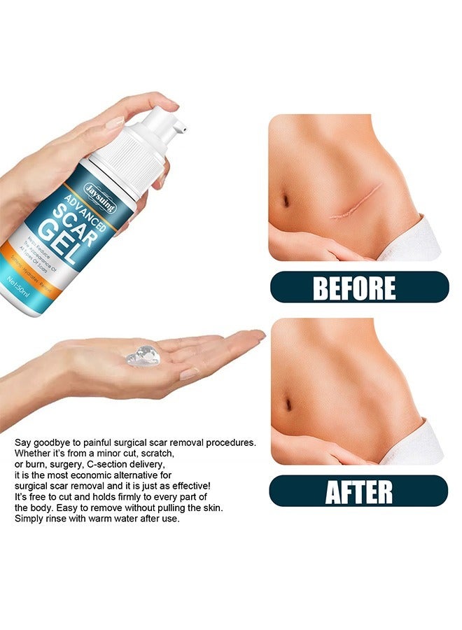 Jaysuing Advanced Scar Gel, Fade Scar Cream Gel，Acne Scar Treatment，Deep Scar Removal，Burns Keloids Hypertrophic, Scar Repair Cream，Suitable for Burn Scar Stretch Marks and Postoperative Repair Treatment - Image 5