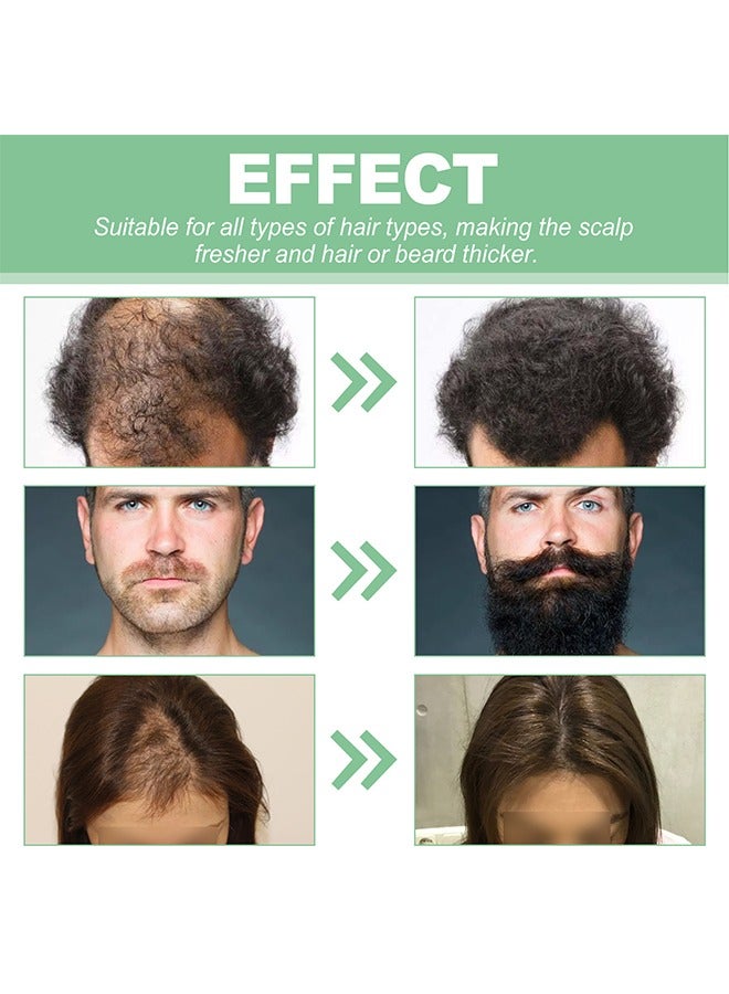 West&Month Strengthening Roll On Hair Essential Oil，Rosemary Hair Growth Essential Oil, with Roller Ball Massage Scalp Moisturizing Hair Roots, Dense Hair Care Oil for Dry Damaged Hair and Growth, Hair Loss Scalp Treatment for Men 18ML - Image 3