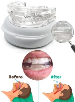 Healthy Anti-Snoring Mouth Guard Adjustable Mouthpiece Night Time Teeth Mouthguard Sleeping Bite Guard for Bruxism and Stop Snoring Custom Molding Adjustability, Snoring Reduction Aid for Men and Women  - Image 1