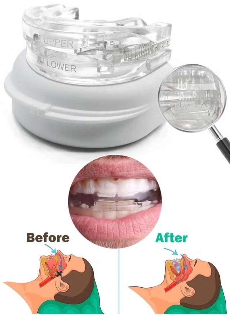 Healthy Anti-Snoring Mouth Guard Adjustable Mouthpiece Night Time Teeth Mouthguard Sleeping Bite Guard for Bruxism and Stop Snoring Custom Molding Adjustability, Snoring Reduction Aid for Men and Women  - Image 1