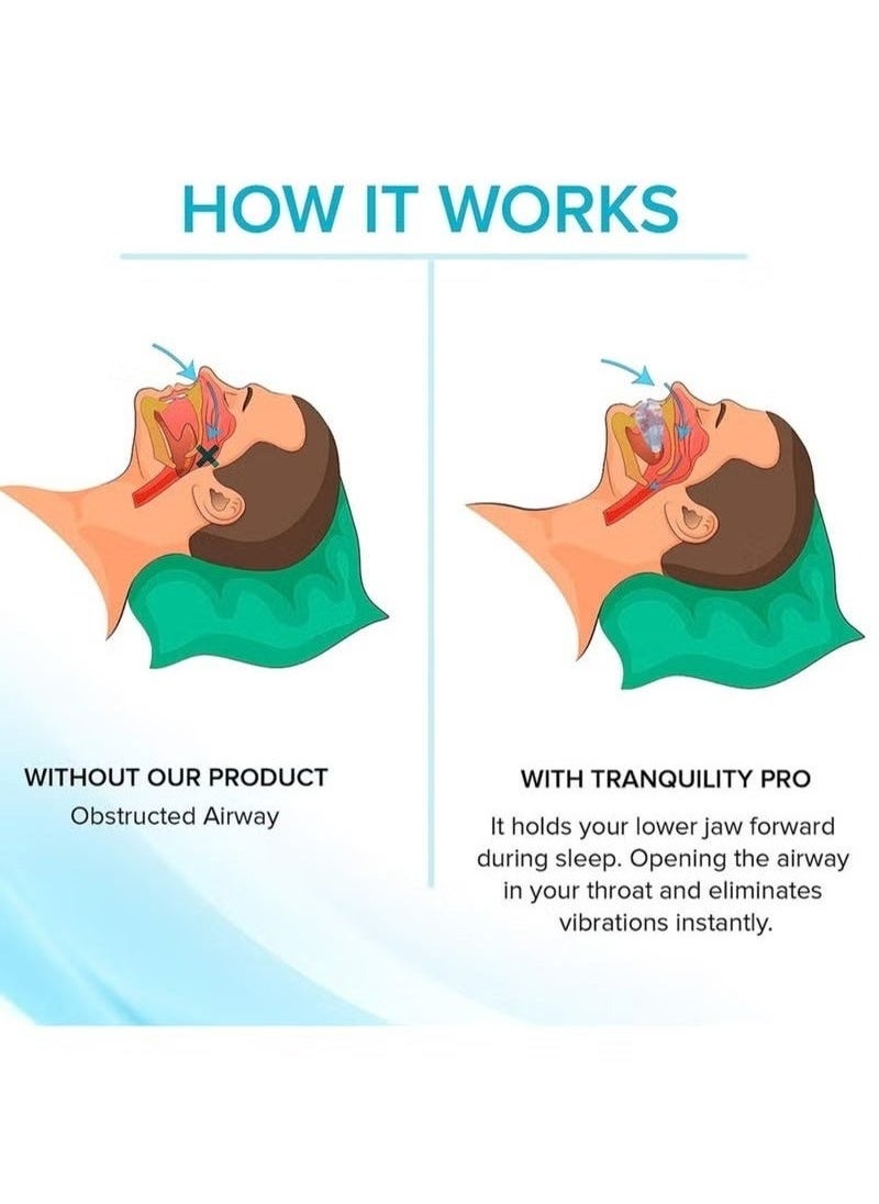 Healthy Anti-Snoring Mouth Guard Adjustable Mouthpiece Night Time Teeth Mouthguard Sleeping Bite Guard for Bruxism and Stop Snoring Custom Molding Adjustability, Snoring Reduction Aid for Men and Women  - Image 5
