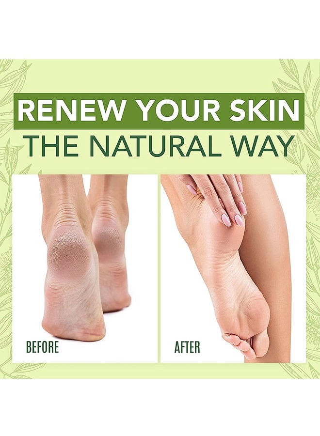 LANEMAY Tea Tree Oil Foot Cream,Cracked Heel Cream For Dead, Cracked,Rough Thick Skin & Dry Feet , Callus Remover Foot Cream , Intensive Moisturizes & Softens Skin, 50ml - Image 3