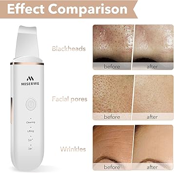 Miserwe Skin Scrubber Face Skin Spatula Blackhead Remover Pore Cleaner Face Beauty Lifting Tool Comedones Extractor with 4 Modes Facial Scrubber Spatula for Deep Cleansing With Two Silicone Case - Image 5