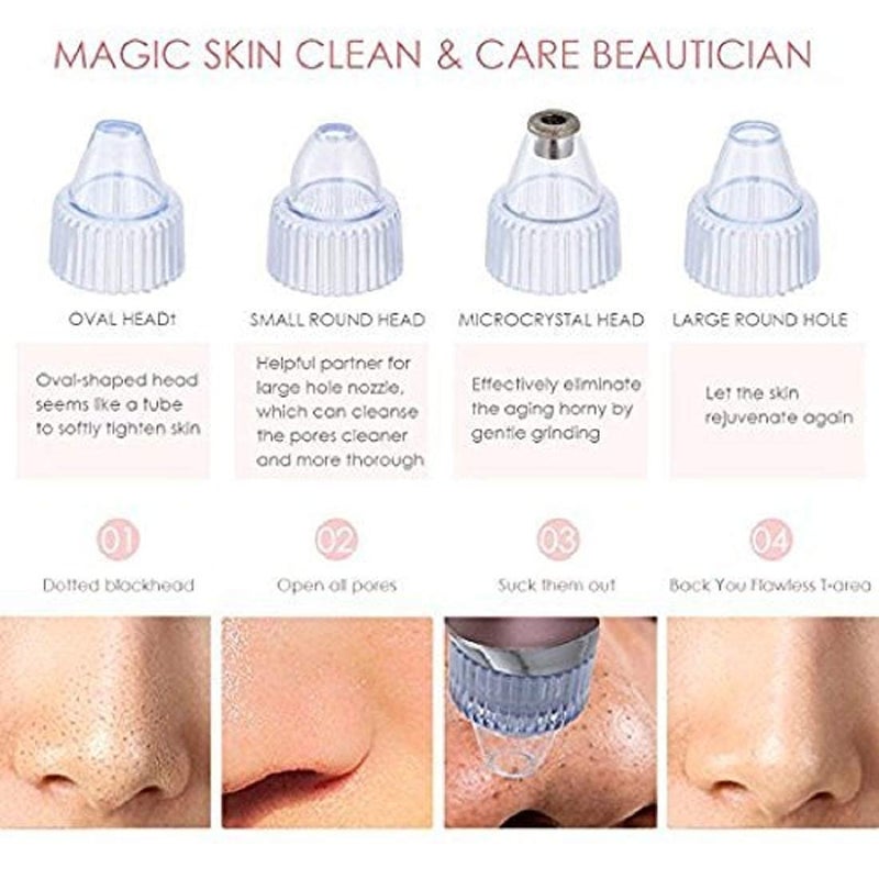 Tendula Skin Care Expert Acne Pore Cleaner Vacuum Blackhead Remover Kit Skin Cleaner Pimple Removal Tool Acne Removal Tool Blackhead Remover Tool - Image 3