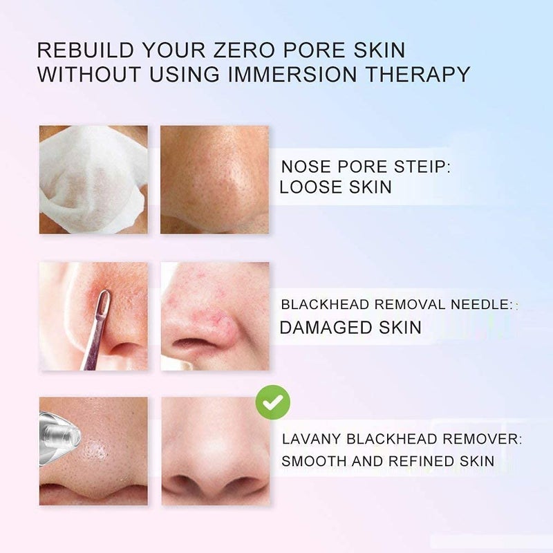 Tendula Skin Care Expert Acne Pore Cleaner Vacuum Blackhead Remover Kit Skin Cleaner Pimple Removal Tool Acne Removal Tool Blackhead Remover Tool - Image 5