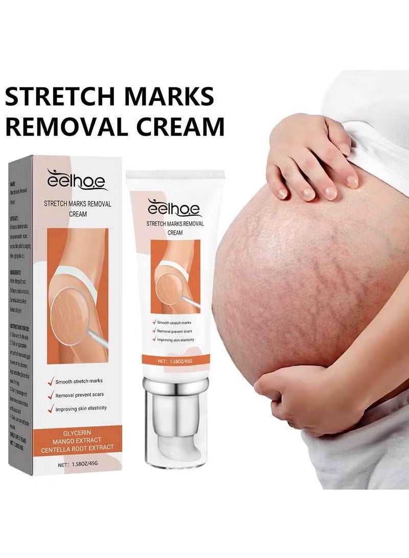 EELHOE Dermease Stretchmarks Removal Cream, Stretch Mark Removal Cream, Stretch Mark Scar Cream, Scar Cream Gel, Scar Care Cream, Help with Stretch Marks, Surgery, Injury, and Burns Scars - Image 4