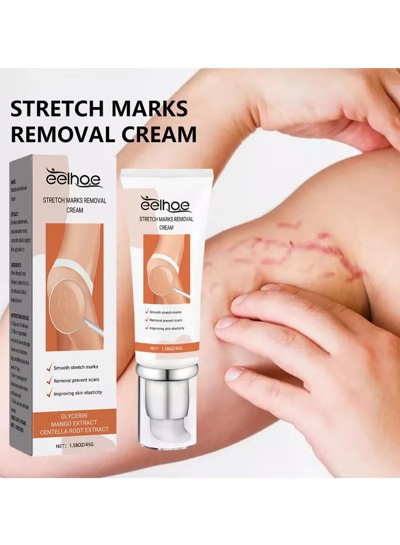 EELHOE Dermease Stretchmarks Removal Cream, Stretch Mark Removal Cream, Stretch Mark Scar Cream, Scar Cream Gel, Scar Care Cream, Help with Stretch Marks, Surgery, Injury, and Burns Scars - Image 3
