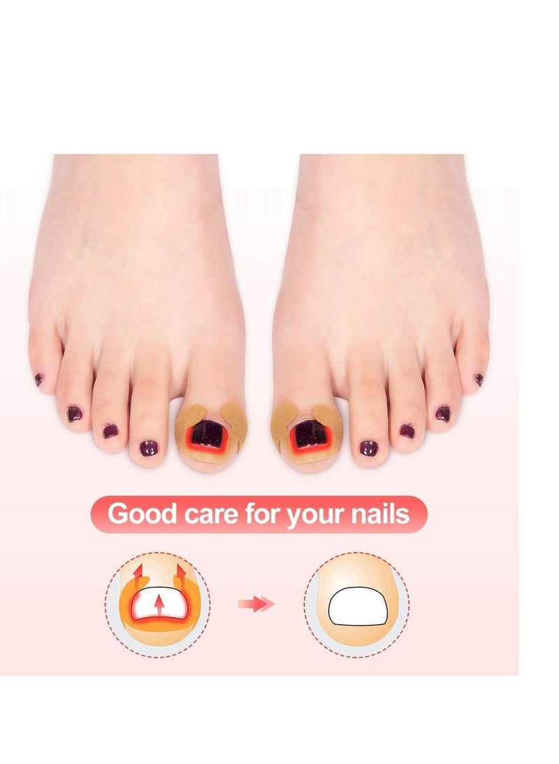 Y&D Paronychia Toenail Treatment Tape Recovery Corrector, 20 posts Ingrown Corrector Stickers - Image 2