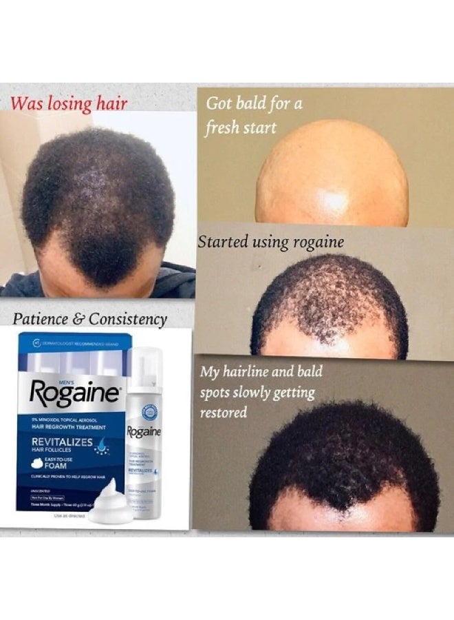 ريجين مينوكسيديل 5% قوة إضافية - Image 2