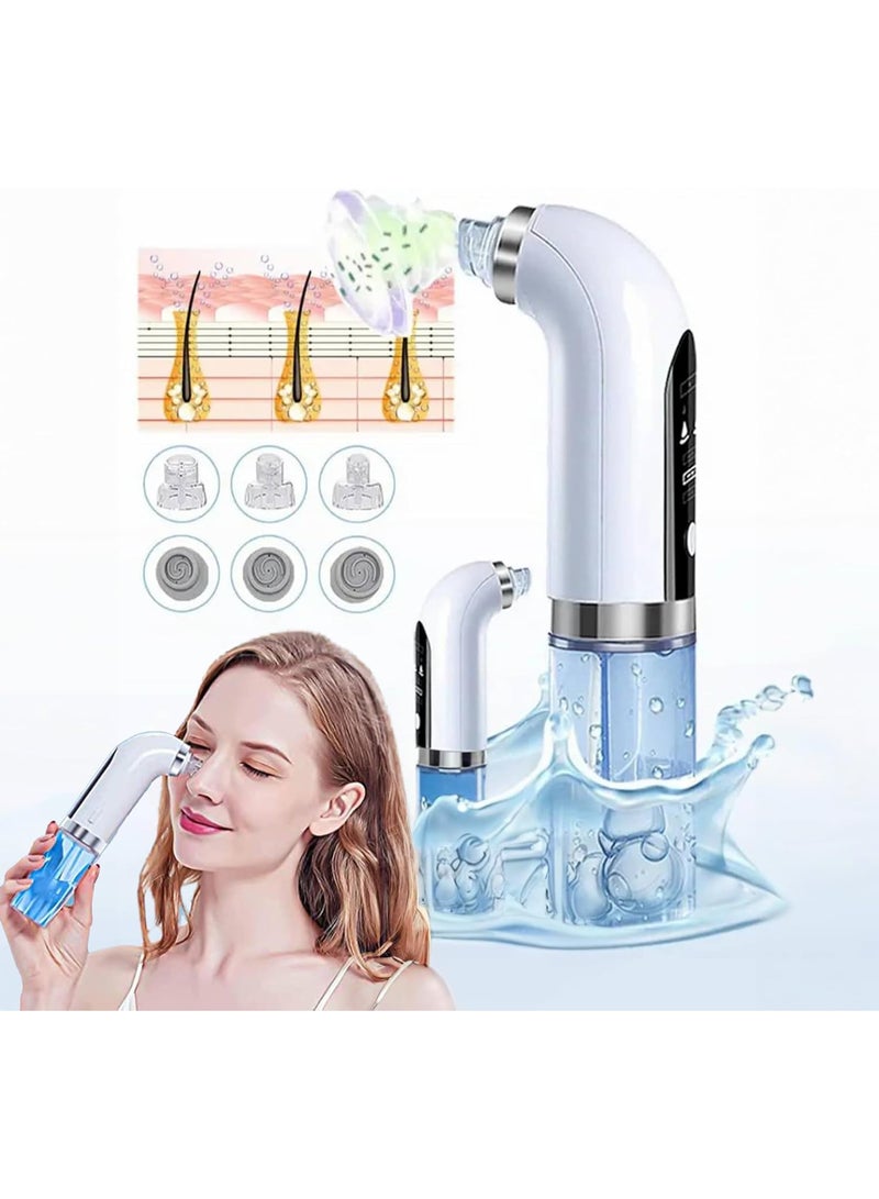 Electric Blackhead Remover – Rechargeable Pore Cleaner with 5 Suction Levels and 4 Cleaning Heads – White - Image 2