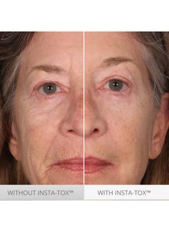 Serious Skincare Instatox Instant Wrinkle Smoothing Serum Trio Improves Appearance Of Fine Lines & Wrinkles Temporarily Tightens Skin Instant Line Filler Three .75 Oz. Tubes (3Pack)  - Image 4