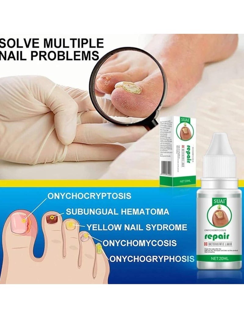 Nail Repair treatment Liquid Nail Fungus Treatment for Damaged Nails Onychomycosis Fungal Nail Renewal Anti Fungus Nail Repair Smooth Hydrates Nail Reduce Discoloration Nail Repair Essence 20ml