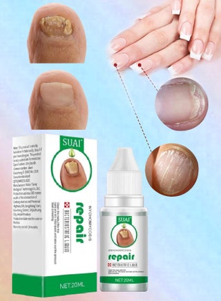 Nail Repair treatment Liquid Nail Fungus Treatment for Damaged Nails Onychomycosis Fungal Nail Renewal Anti Fungus Nail Repair Smooth Hydrates Nail Reduce Discoloration Nail Repair Essence 20ml - pzsku/ZA15D984A4A1CB7374773Z/45/_/1721383730/29fe347d-c4db-438f-bce2-f66a87c0cf43