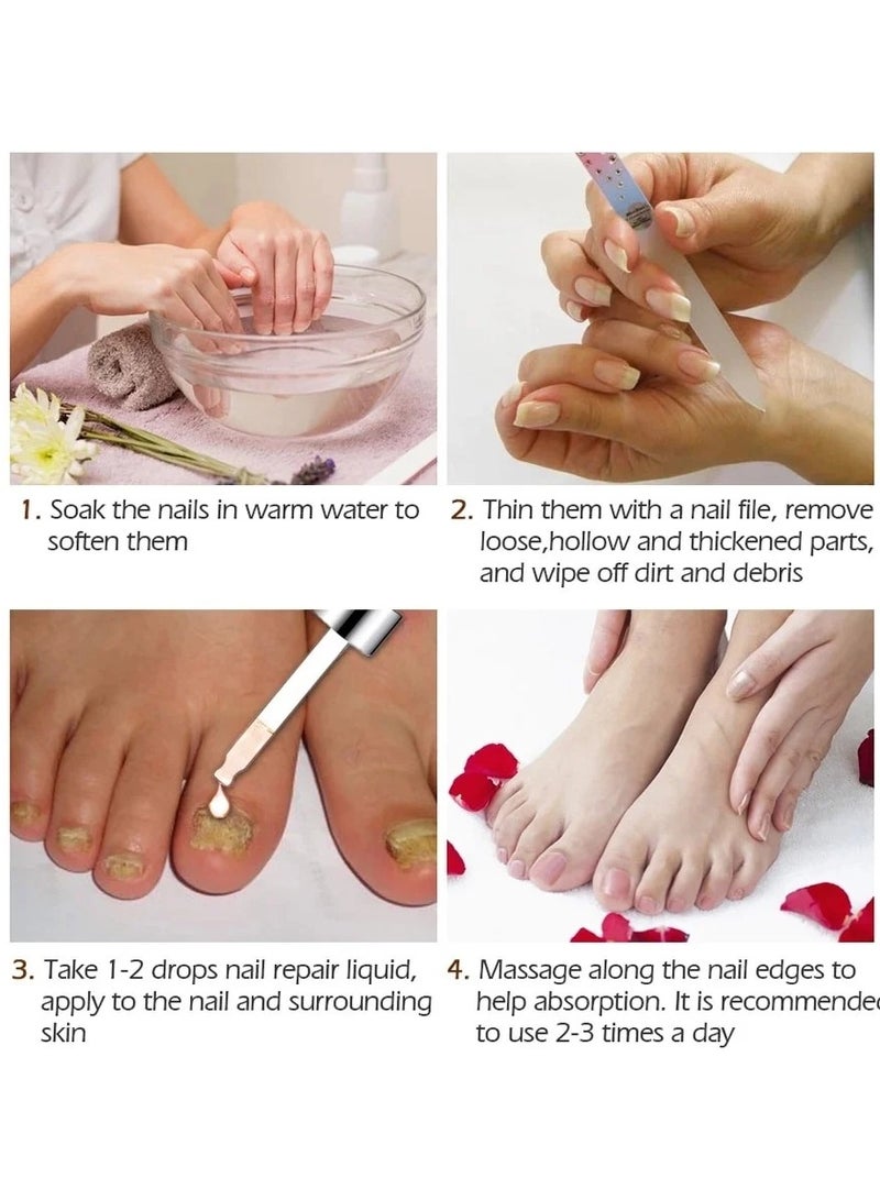 Nail Repair treatment Liquid Nail Fungus Treatment for Damaged Nails Onychomycosis Fungal Nail Renewal Anti Fungus Nail Repair Smooth Hydrates Nail Reduce Discoloration Nail Repair Essence 20ml