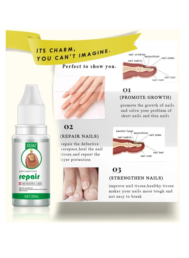Nail Repair treatment Liquid Nail Fungus Treatment for Damaged Nails Onychomycosis Fungal Nail Renewal Anti Fungus Nail Repair Smooth Hydrates Nail Reduce Discoloration Nail Repair Essence 20ml
