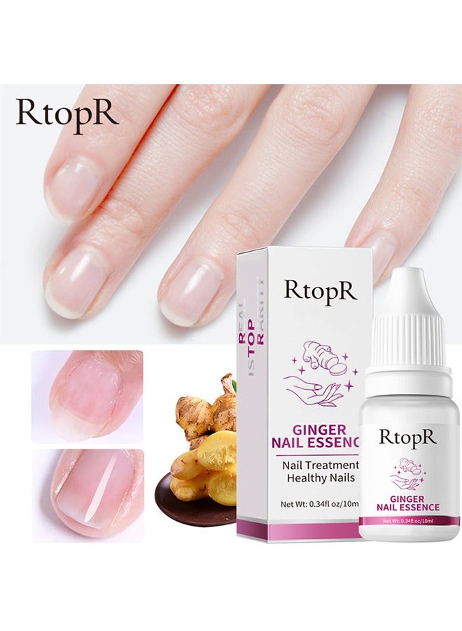 RtopR Ginger Nail Repair Essence 10ml, Has Antifungal And Antibacterial Properties, Relieves Nail Infections, And Promotes Nail Healing, Nail Treatment Healthy Nails  - Image 1