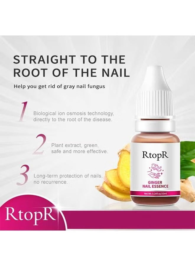 RtopR Ginger Nail Repair Essence 10ml, Has Antifungal And Antibacterial Properties, Relieves Nail Infections, And Promotes Nail Healing, Nail Treatment Healthy Nails  - Image 3