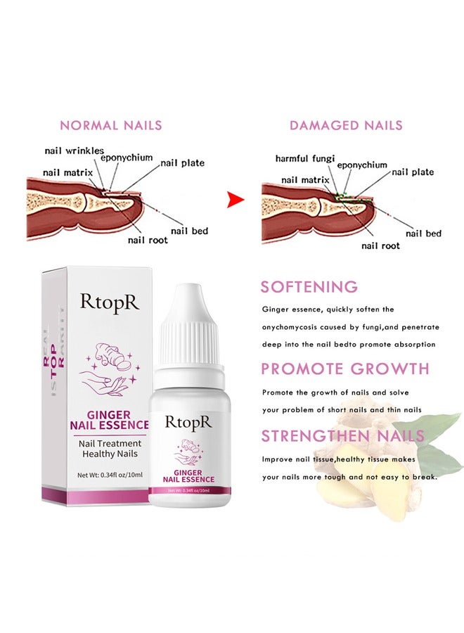 RtopR Ginger Nail Repair Essence 10ml, Has Antifungal And Antibacterial Properties, Relieves Nail Infections, And Promotes Nail Healing, Nail Treatment Healthy Nails  - Image 5