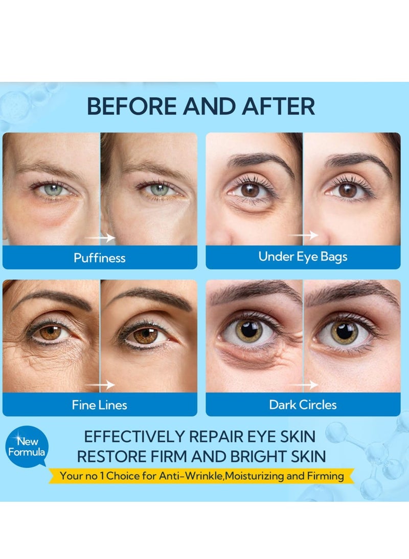 LANBENA Hyaluronic Acid Hydra-Gel Eye Mask Sheet Collagen Eye Patches Skin Care Eye Gel for Moisturizing Remove Dark Circles Eye Bag (30 Pairs) - Image 5