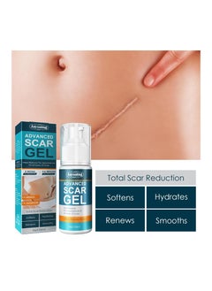 Jaysuing Scar Reduction Cream Postpartum Stretch Mark Repair Cream  - Image 3