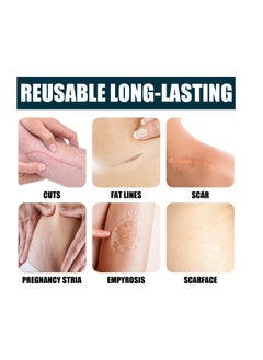 Jaysuing Scar Reduction Cream Postpartum Stretch Mark Repair Cream  - Image 5