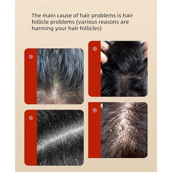 New Cover Natural Black Shampoo with He Shou Wu & Leaf of Oriental Arborvitae for Men & Women - 500ml Anti-Dandruff Hair Growth Shampoo, Platycladus Orientalis Leaf Moisturizing Scalp Hair Care - Image 4
