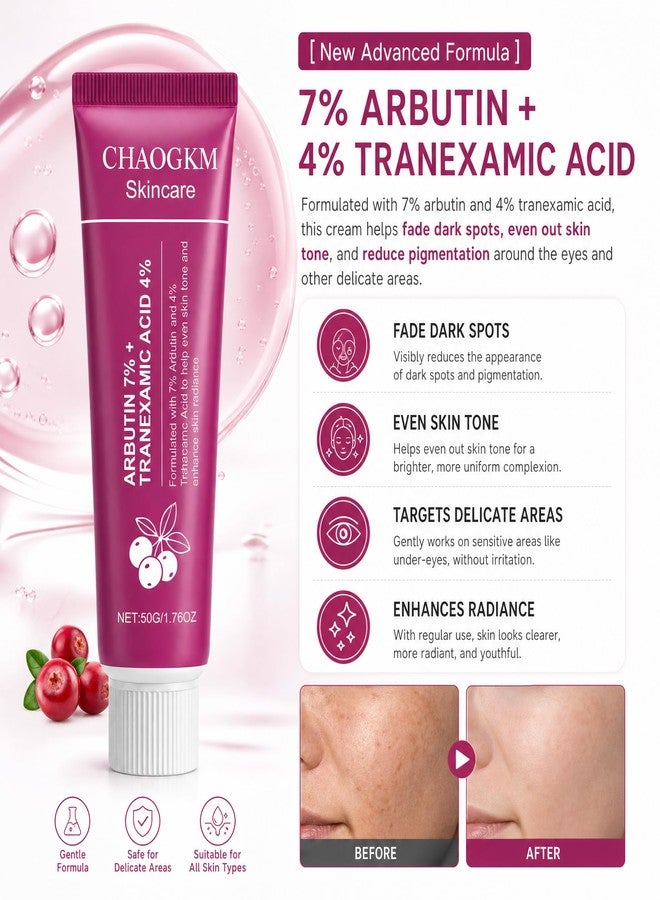 CHAOGKM SOERA Korean Brightening Cream丨Arbutin&Tranexamic Acid Facial Cream - Image 4