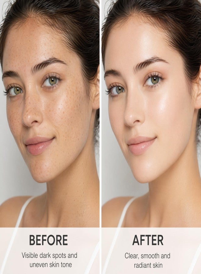 CHAOGKM SOERA Korean Brightening Cream丨Arbutin&Tranexamic Acid Facial Cream - Image 3