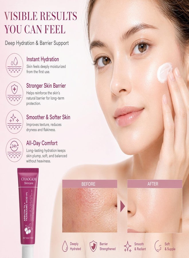 CHAOGKM SOERA Korean Brightening Cream丨Arbutin&Tranexamic Acid Facial Cream - Image 5