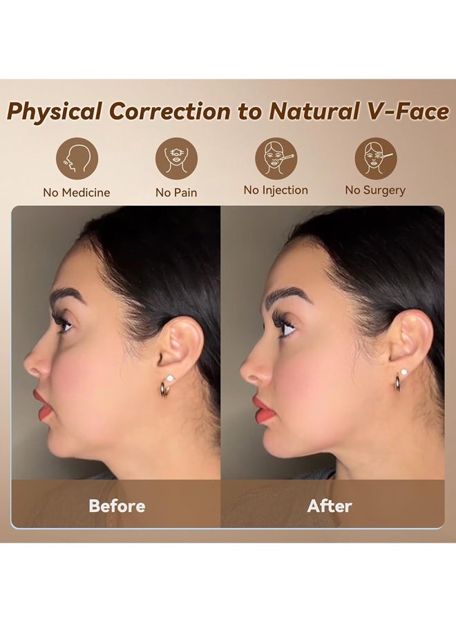 LLASIDO V-Line Mask Chin Up Mask Face Strap, Soft Silicone Chin Strap V Shaped Face Mask - Image 2