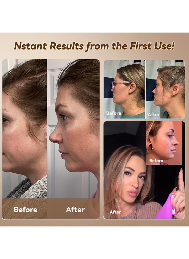 LLASIDO V-Line Mask Chin Up Mask Face Strap, Soft Silicone Chin Strap V Shaped Face Mask - Image 3