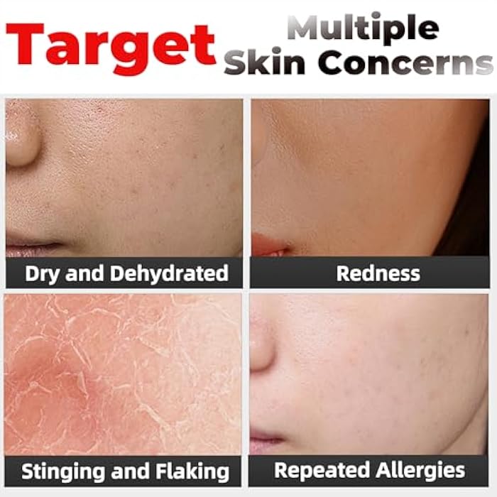 Elitzia Oxygen Facial Machine Oxygen Infusion Device Oxygen Sprayer Facial Nutrient Solution Set SPA Skincare Facial Machine Anti Aging Beauty Salon Machine 1.69fl.oz Per Bottle - Image 5