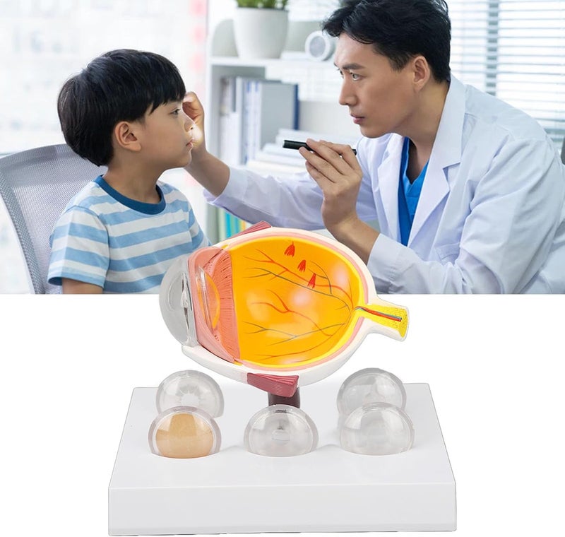 klarako Enlarged Human Eye Anatomical Model - Accurate Shows Optic Nerves Cornea Iris Lens Eyeball Model - Image 3