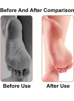 Generic Electric Foot File Callus,Rechargeable,Portable Electronic Foot File Pedicure Tools,Professional Pedi Feet Care,Remover,Perfect for Dead,Hard Cracked Dry Skin Ideal Gift  - Image 4
