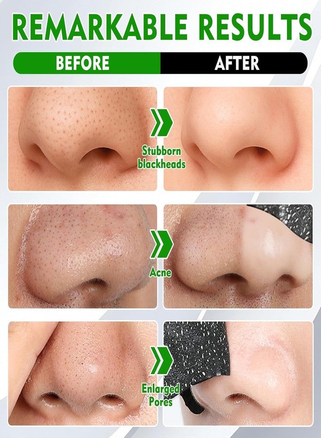 Rexez Blackhead Remover Nose Strips (10 * 2 Pack) | Deep Cleansing & Oil Control Pore Strips for All Skin Types | Easy Blackhead & Impurity Removal - Image 3