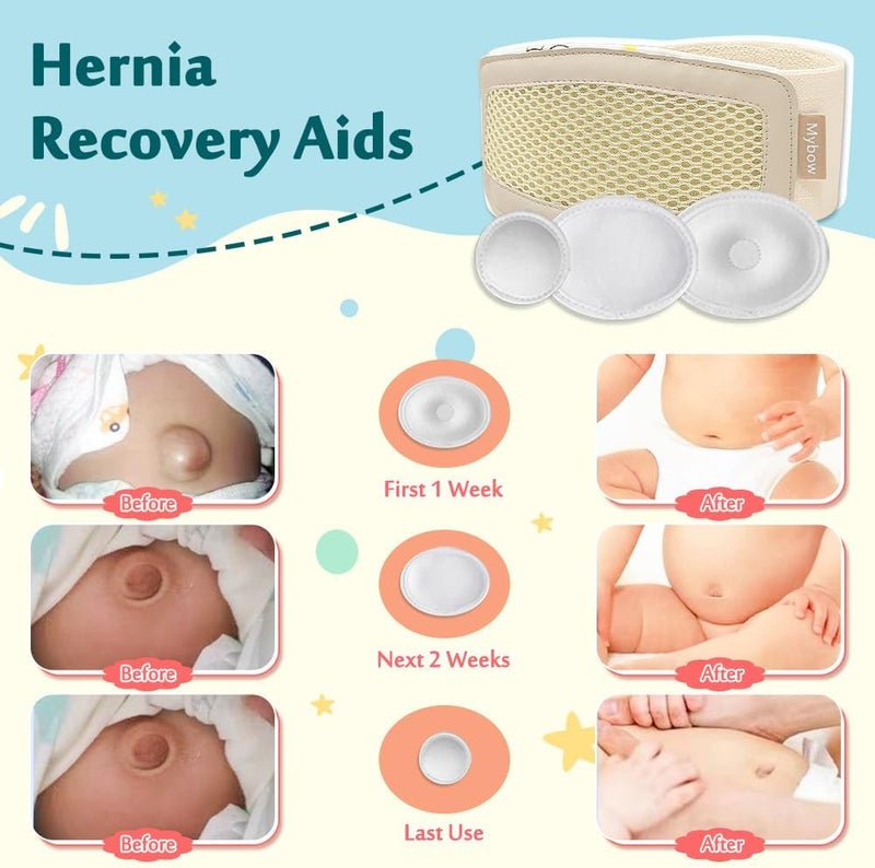 Mybow Umbilical Hernia Belt Baby, Infant Belly Button Band, Umbilical Cord Cover for Newborn Abdominal Binder, Hernia Support Truss, Belly Button Shaper, Adjustable Navel Band with 3 Compression Pad - Image 3