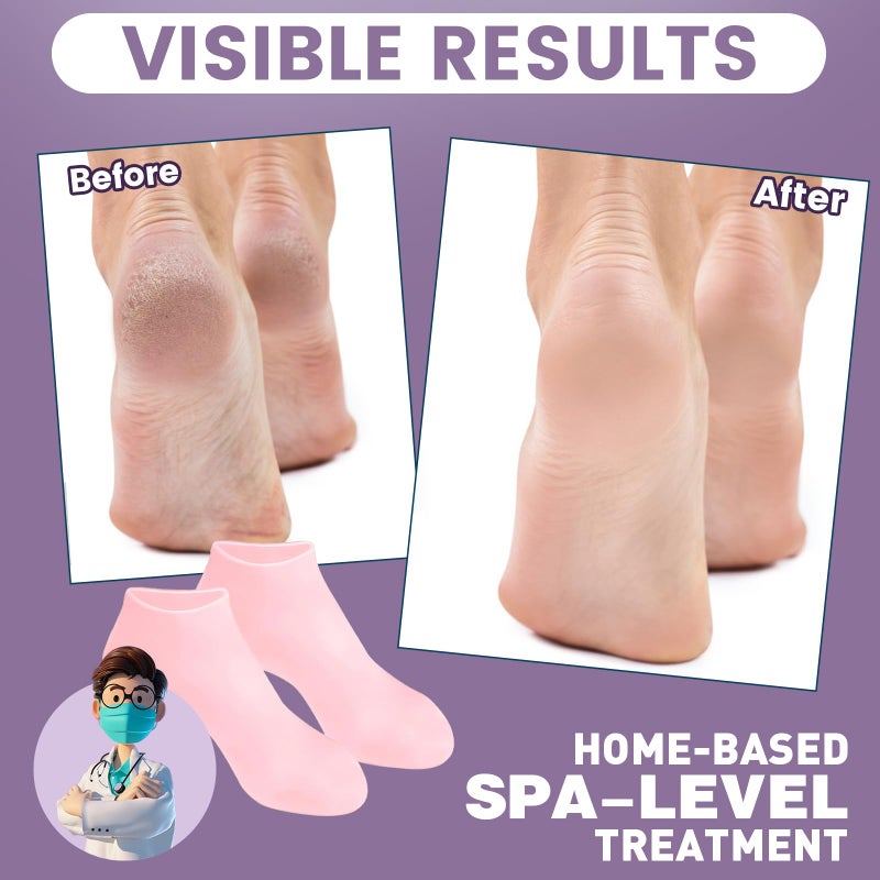 TEAWOO 5 Pairs Silicone Socks for Dry Cracked Feet, Women's Moisturizing Foot Socks (Pink, Fits Up to Size 9) - Image 3