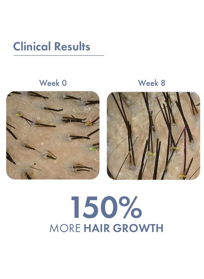 ثريفيكو سيروم نمو الشعر ThriveCo 2.0 رول أون | مثبت سريريًا أنه يقلل تساقط الشعر ويعزز نموه | مُعزز بـ Redensyl وProcapil وAnagain | مدعوم من أبحاث طبية بريطانية | خفيف الوزن، غير لزج | للرجال والنساء - 10 مل - Image 4