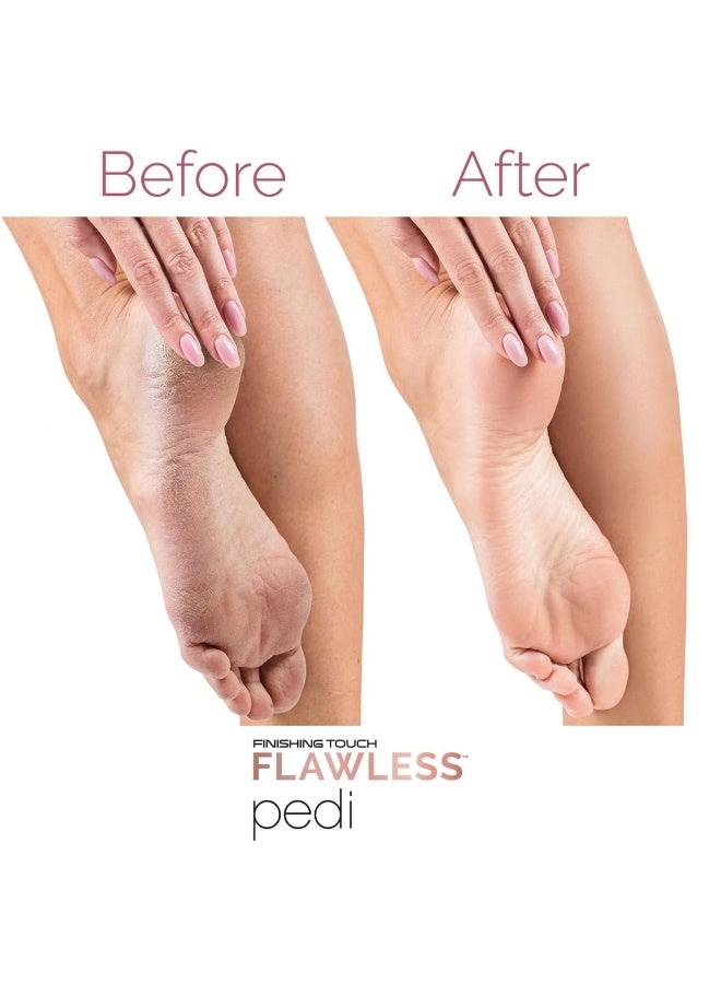 جهاز فلو ليس بيدي (Flawless Pedi) للعناية بالقدمين والباديكير - مزيل الكالوس والجلد الميت القابل لإعادة الشحن، سرعتان مع رأسين بديلين لنعومة فائقة في المنزل. - Image 4
