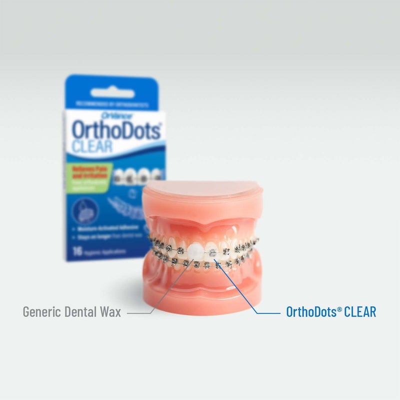 Orvance OrthoDots CLEAR – Moisture Activated Braces Wax Alternative for Pain Caused by Braces, Clear Aligner Trays, and Other Orthodontic Appliances. OrthoDots Stick Better and Stay on Longer than Dental Wax. - Image 5