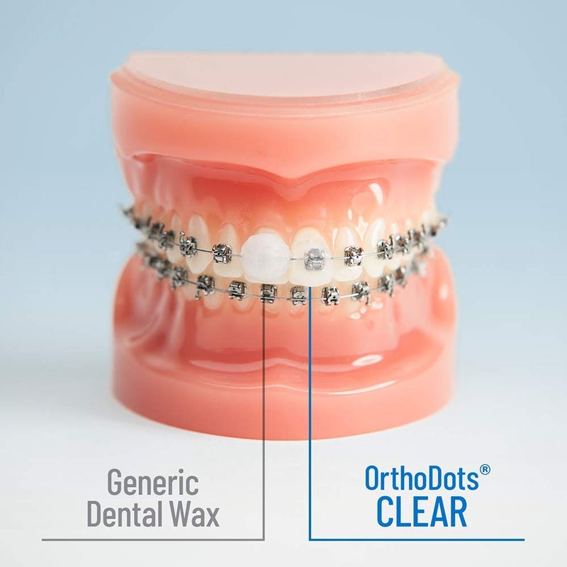 Orvance OrthoDots CLEAR – Moisture Activated Braces Wax Alternative for Pain Caused by Braces, Clear Aligner Trays, and Other Orthodontic Appliances. OrthoDots Stick Better and Stay on Longer than Dental Wax. - Image 4